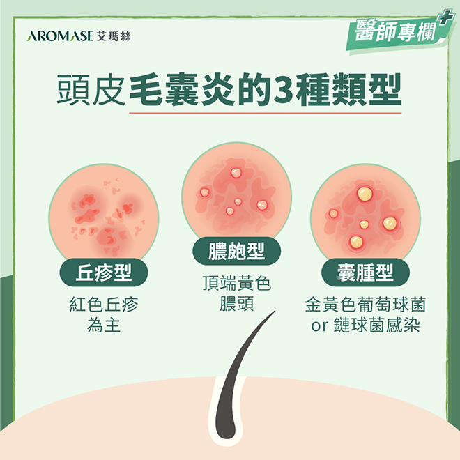 臉部生暗瘡,頭皮也會生暗瘡!? | 𝗔𝗥𝗢𝗠𝗔𝗦𝗘.𝗛𝗞 3